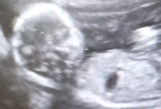 Sœur Marie de la Sagesse